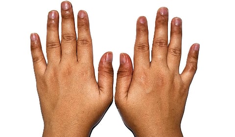 நீலம் பூக்கும் குழந்தைகள் | இதயம் போற்று 48