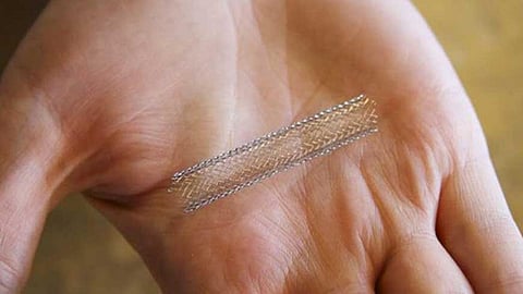 இந்​தி​யா​வில் தயாரிக்​கப்​பட்ட புதிய தலை​முறை இதய ஸ்டென்ட்​டுக்கு உலகளா​விய அங்​கீ​காரம் கிடைத்​துள்​ளது