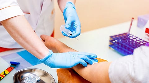 சிறிய ரத்தப் பரிசோதனை நிலையங்களை மூடும் வகையிலான அரசாணையை எதிர்த்து உண்ணாவிரத போராட்டம் அறிவிப்பு