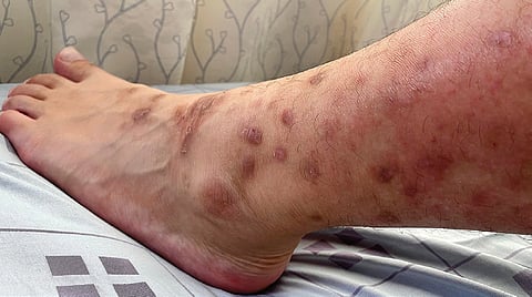 தோல் நோய்: சில புரிதல்கள் | நலம் வாழ கேள்வி - பதில்