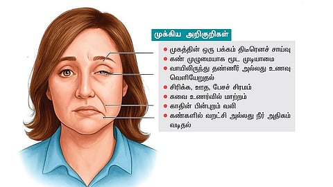 குளிர்காலத்தில் முகவாதம் ஏன் ஏற்படுகிறது?