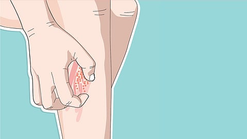 குளிர்காலத்தில் அதிகரிக்கும் தோல் அரிப்பு | நலம் வாழ கேள்வி - பதில்