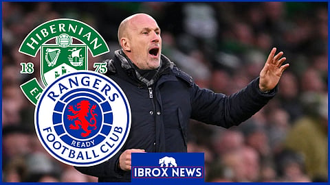 Philippe Clement prepares for Rangers v Hibernian.