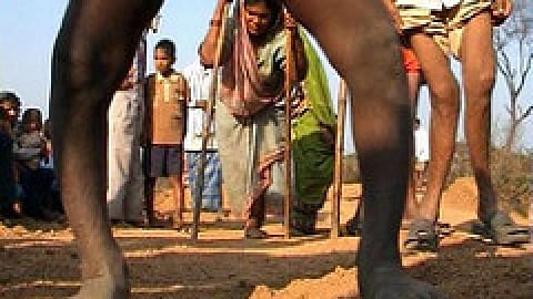 fluorosis