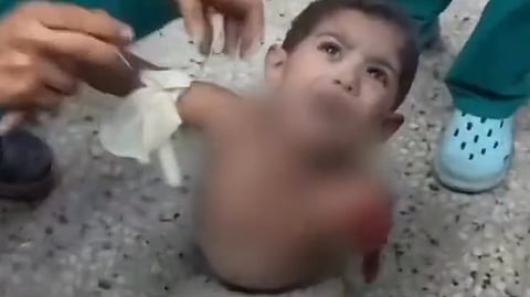 A child injured in an Israeli airstrike on the Cairo School in Gaza City, Jul 25, 2025.