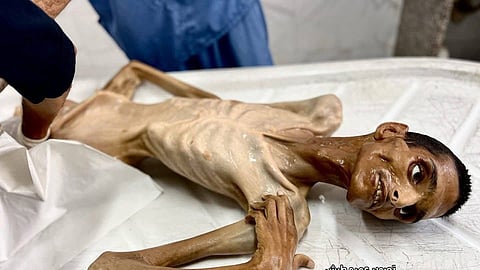 Adel Madi died at 27 years old.