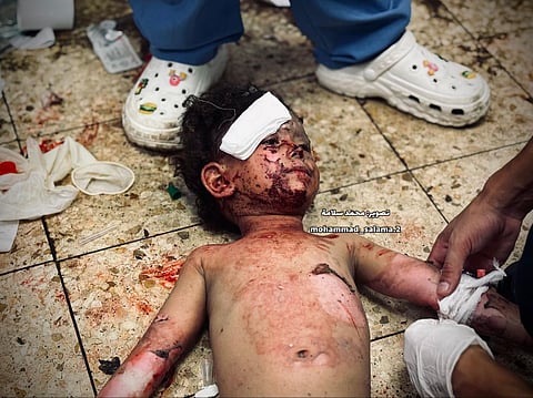 Israeli Attacks Kill 44, Including 22 Aid Seekers, Amid Gaza Starvation