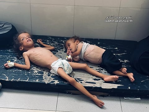 Starving Palestinian children in Gaza, August 2025.