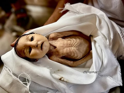 Five month old infant Ghadir Briken who died at Nasser Medical Complex after suffering from severe malnutrition, 22 August 2025.
