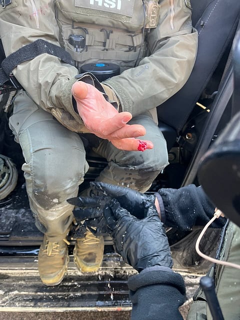 The HSI officer that lost his finger after it was bitten off by protestors.