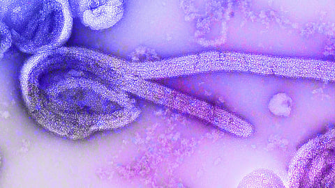 An electron microscopic image of the 1976 isolate of Ebola virus.