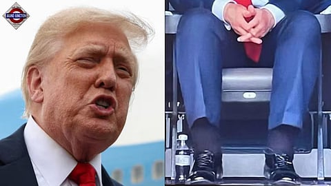 US President Donald Trump was seen with swollen ankles and bruised hands at the FIFA Club World Cup. 