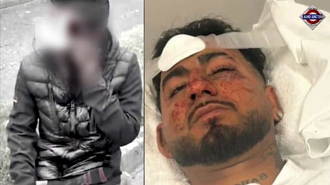 Wave of Racist Attacks Against Indian Nationals in Australia and Ireland Spark Global Outrage