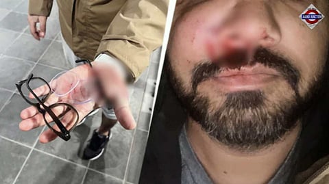 Indian-Origin Man Brutally Attacked in Dublin, Sparks Concerns Over Rising Racist Violence