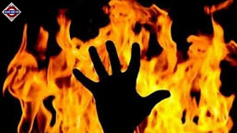 Odisha Minor, Set On Fire 2 Weeks Ago, Dies In Delhi; Fresh Twist Emerges In Police Probe