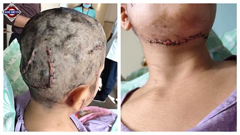 The woman received over 50 stitches as a result of the dog attack.