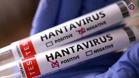 "This Is Not Covid, Nor Influenza. It Spreads Very Differently": WHO On Hantavirus Outbreak