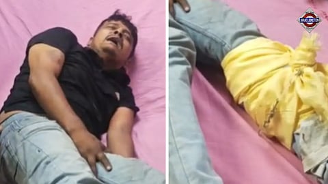 The accused, arrested in connection with the Delhi child murder case, was injured in the leg during an alleged attempt to escape police custody.