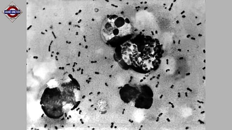 Russian lab put under anti-epidemic lockdown after suspected plague death