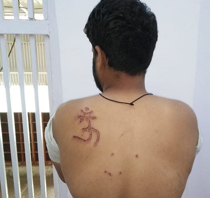 திஹார் சிறையில் உள்ள கைதியின் முதுகில் ‘ஓம்’ என்று சூடு வைத்த சிறை கண்காணிப்பாளர் !