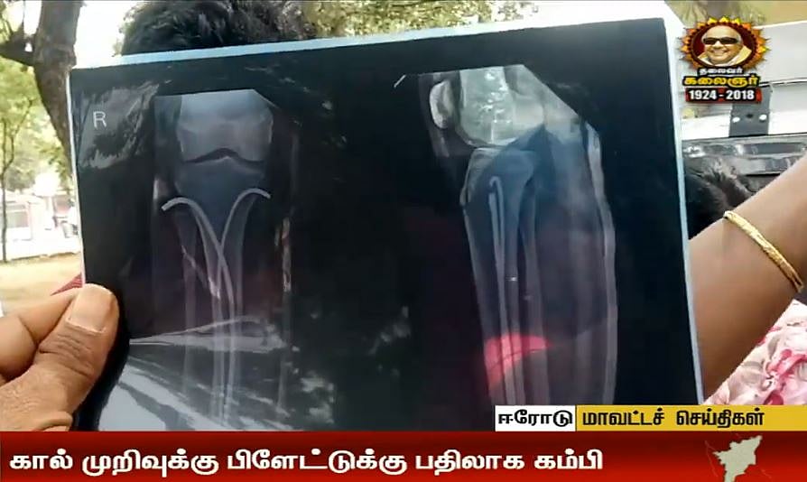 மெர்சல் பட பாணியில் கமிஷன் வேலை பார்த்த டிரைவர்... சிறுமிக்கு நேர்ந்த கொடூரம்...