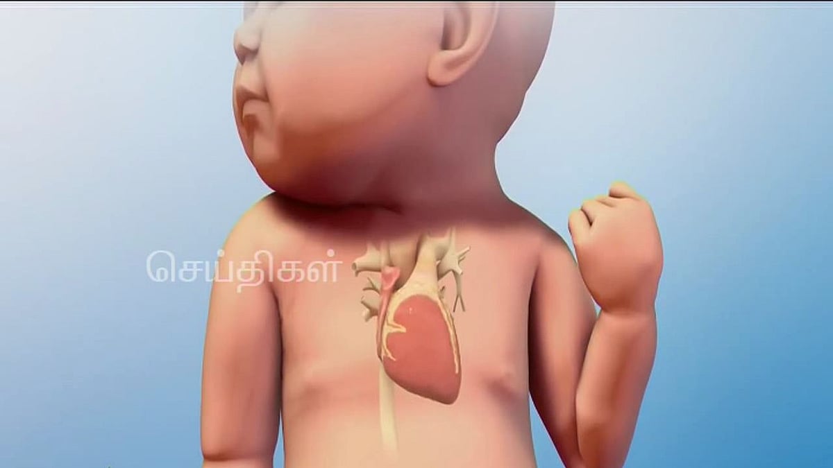வலதுபுறம் துடிக்கும் இதயம் - உயிரைக் கையில் பிடித்தப்படி போராடும் குழந்தை; கை விரித்த அரசு மருத்துவமனை!