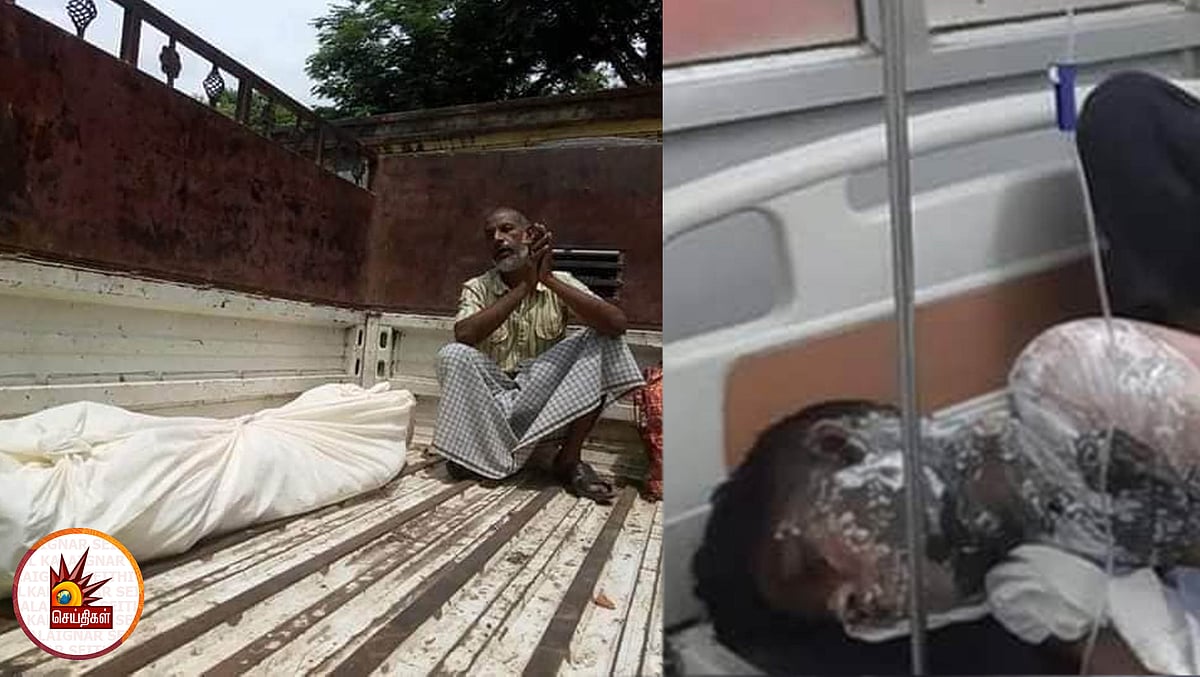 ‘ஜெய் ஸ்ரீராம்’ சொல்லாததால் தீ வைக்கப்பட்ட முஸ்லிம் சிறுவன் பலி - உடலை லாரியில் கொண்டு சென்ற அவலம்