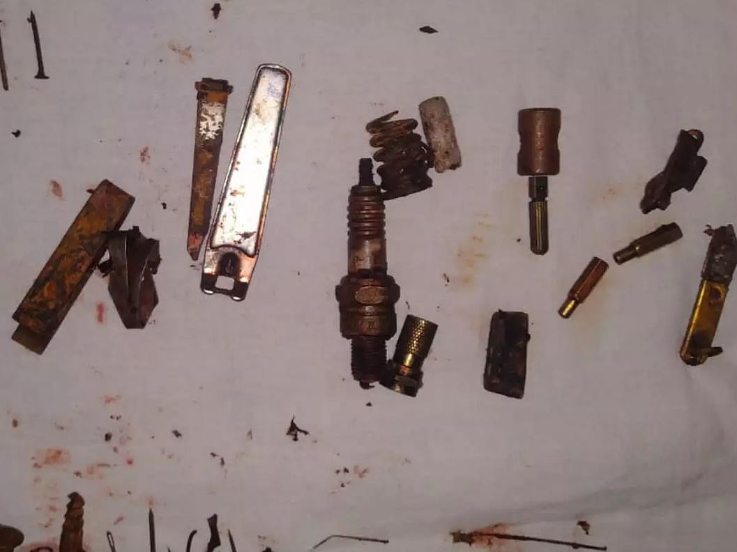 வாலிபரின் வயிற்றில் 3.5 கிலோ இரும்பு பொருட்கள் : அறுவை சிகிச்சையில் அதிர்ச்சி அடைந்த மருத்துவர்கள் ! ஏன்?