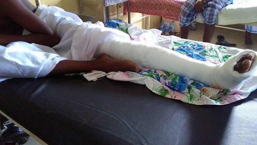 போலீஸ் காவலில் இருந்து தப்பித்த கைதி : கால் முறிவு ஏற்பட்டு மருத்துவமனையில் அனுமதி! நடந்தது என்ன?