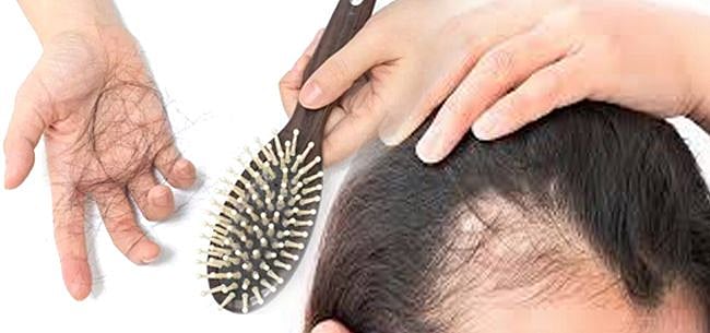 முடி உதிர்வு குறித்து கவலைப்படுகிறீர்களா? இந்த 2 விஷயங்களை சரி செய்யுங்கள் போதும்!