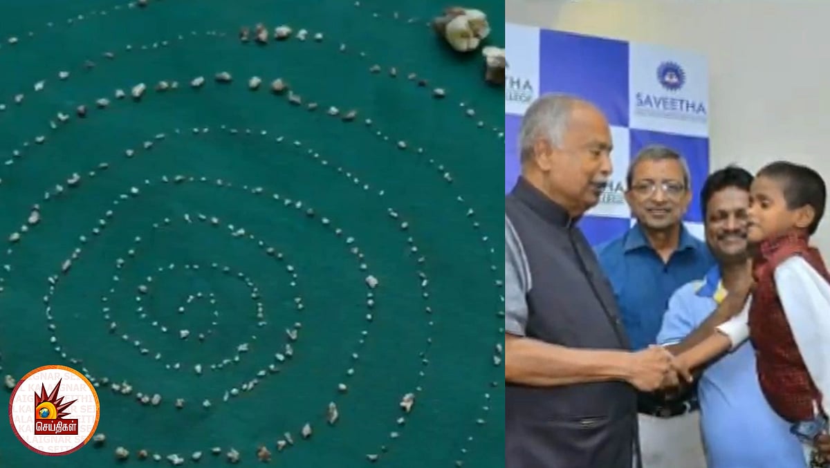 சிறுவனின் வாயில் 526 பற்கள்! -  அதிர்ந்து போன மருத்துவர்கள்