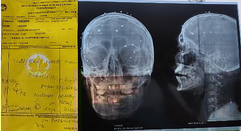 எக்ஸ்-ரே ஆதாரம்