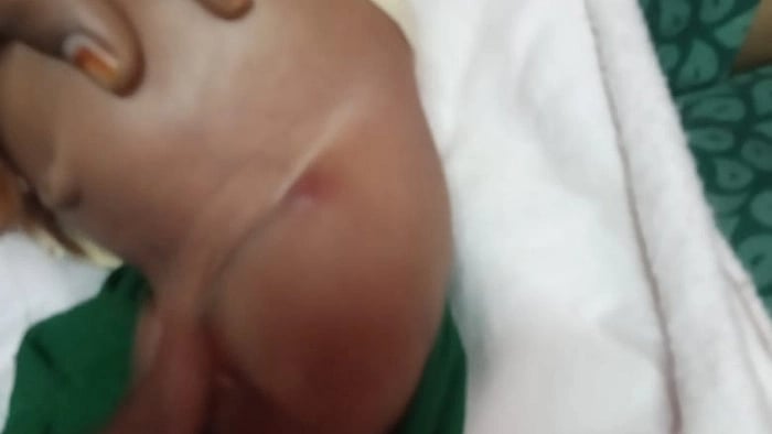 பிறந்த குழந்தையின் உடலில் 20 நாட்களாக கிடந்த ஊசி... தொடரும் அரசு மருத்துவமனையின் அலட்சியம்!