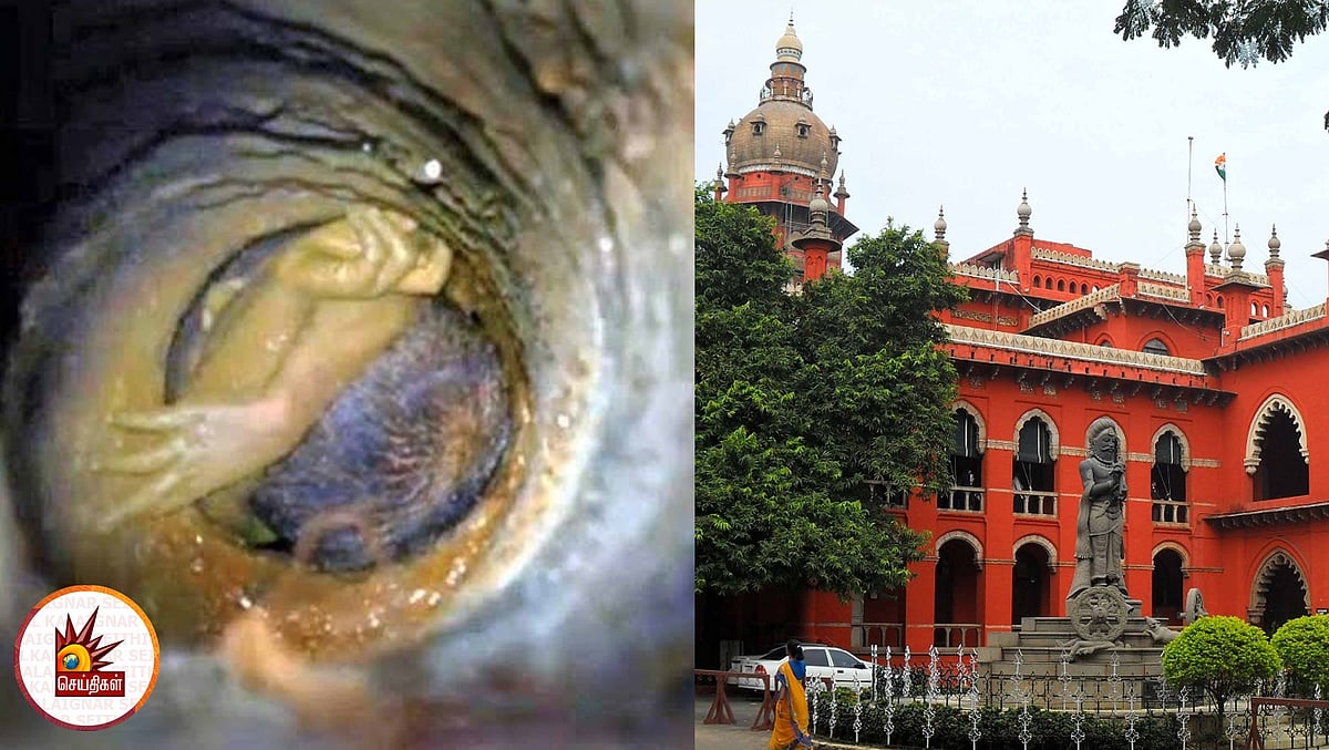 உயிர் பலி ஏற்பட்டால்தான் நடவடிக்கை எடுக்கப்படுமா? - தமிழக அரசுக்கு ஐகோர்ட் சரமாரி கேள்வி!