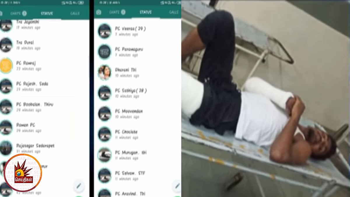 புதுச்சேரி வரை கிளைபரப்பிய தமிழ்நாடு போலிஸின் மாவுக்கட்டு ஸ்டைல்: போலிஸாரை தாக்கிய ரவுடிக்கு மாவுக்கட்டு!