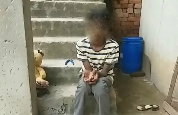 அரசு மருத்துவரின் அலட்சிய சிகிச்சையால் விரல்களை இழக்கும் நிலையில் மாணவன் - சென்னையில் அதிர்ச்சி சம்பவம்!