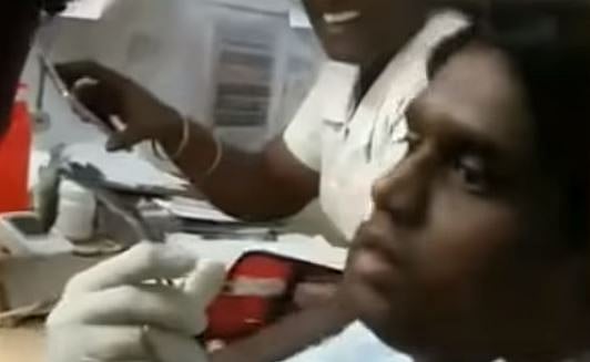 சிறுவனின் மூக்கில் சிக்கிய மீன் : சாதுர்யமாக வெளியே எடுத்த மருத்துவர் - புதுக்கோட்டை அருகே பரபரப்பு!