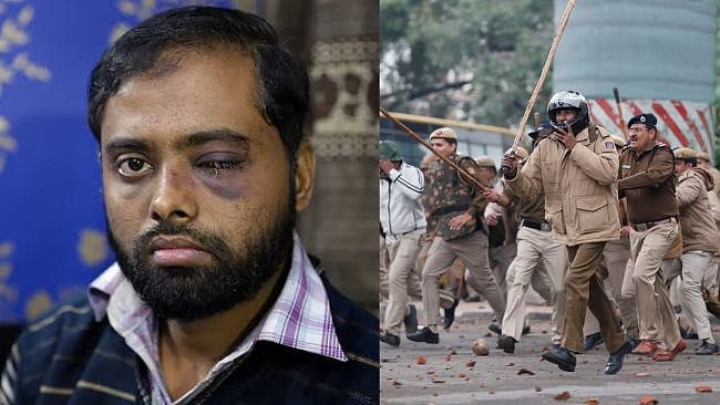 ’போலிஸ் அல்ல; ரவுடிகள் ?’ : ஜாமியா தாக்குதலில் கண் பார்வையை பறி கொடுத்த மாணவர் அதிர்ச்சி வாக்குமூலம் !