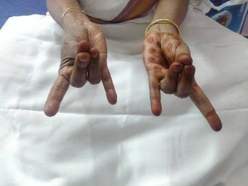 பருவ வயது பிள்ளைகளுக்கு பெற்றோர் கற்றுத் தர வேண்டிய மான் முத்திரை - நலம் நலம் அறிக ! (வீடியோ)