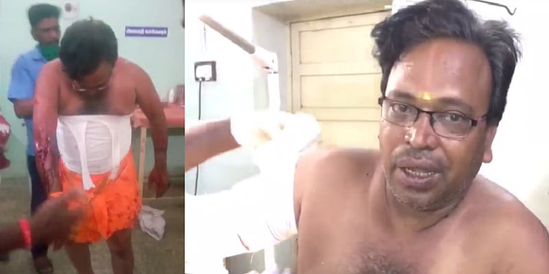 “அரசியல் சுயவிளம்பரத்திற்காக தன்னைத்தானே வெட்டிக்கொண்டு நாடகம்” : இந்து மக்கள் கட்சி நிர்வாகி கைது!