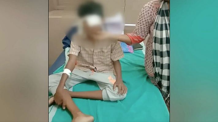 ஆசிரியை தாக்கியதால் கண் பார்வையை இழந்த 8ம் வகுப்பு மாணவன்; சென்னையில் பரிதாபம்!
