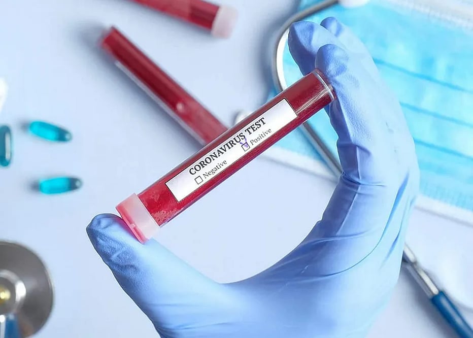 “17 வெளிநாட்டினர் உட்பட 85 பேருக்கு கொரோனா பாதிப்பு” : மத்திய சுகாதாரத்துறை வெளியிட்ட அதிர்ச்சி தகவல்!