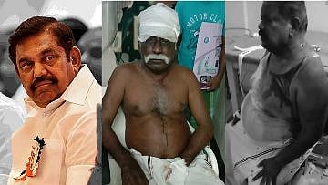 “கொலைவெறியில் அ.தி.மு.க; சொந்தக் கட்சிகாரர்களையே வெட்டி மண்டையை உடைத்த கொடூரம்” : பெரம்பலூரில் பரபரப்பு!