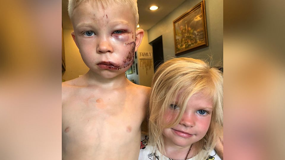 “தங்கைக்காக நாயிடம் உயிரைப் பணயம் வைத்து போராடிய 6 வயது சிறுவன்”- நிஜ ஹீரோ என சூப்பர் ஹீரோக்கள் பாராட்டு!