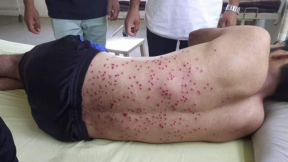 காஷ்மீரில் மொஹரம் ஊர்வலம் சென்றவர்கள் மீது பெல்லட் குண்டு தாக்குதல் - 19 ஷியா முஸ்லிம்கள் படுகாயம்!