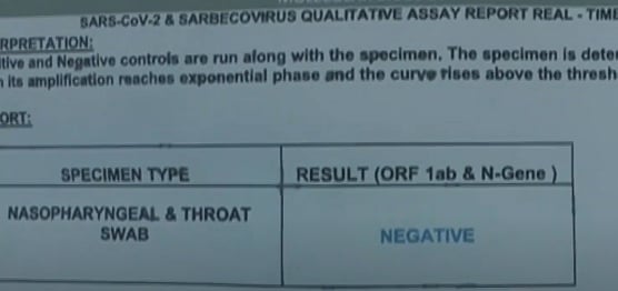 செலவு கணக்கை ஈடுகட்ட கொரோனா இல்லாதவர்களுக்கு பாசிட்டிவ் முத்திரை: எடப்பாடி அரசின் கொரோனா கொள்ளை அம்பலம்!