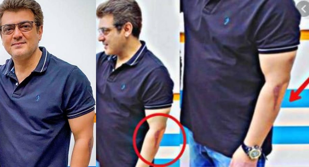 'வலிமை’ படத்திற்காக ‘வெய்ட்’ குறைத்த அஜித் : ரசிகர்களுடன் எடுத்த புகைப்படத்தில் அஜித்தின் கையில் தழும்பு!