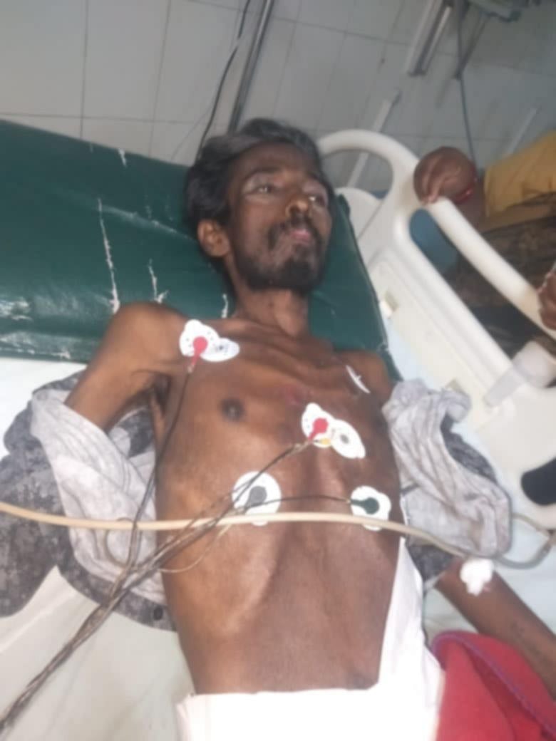 லலிதா ஜுவல்லரியில் கொள்ளையடித்த கொள்ளையன் முருகன் உடல்நலக் குறைவால் மரணம்!