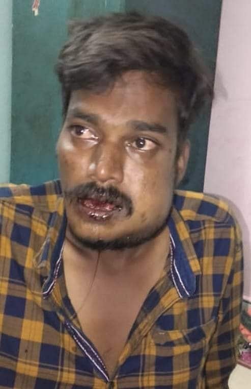 “சாத்தான்குளம் சம்பவத்திற்குப் பிறகும் திருந்தாத காவல்துறை” : தலித் இளைஞரை அடித்து உதைத்த மதுரை போலிஸ்!