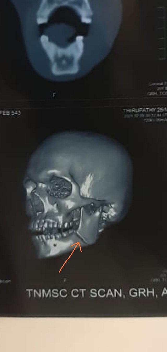 “சாத்தான்குளம் சம்பவத்திற்குப் பிறகும் திருந்தாத காவல்துறை” : தலித் இளைஞரை அடித்து உதைத்த மதுரை போலிஸ்!